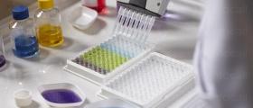 Имунологични изследвания Пловдив и Хасково Имунологични изследвания Пловдив и Хасково