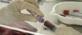 Изследване на туморни маркери в София-Възраждане - СМДЛ Перфект Лаб 