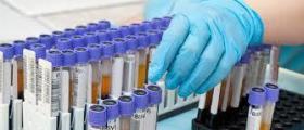 Лабораторни изследвания в Омуртаг Лабораторни изследвания в Омуртаг
