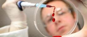 Лабораторни изследвания в София-Младост - ДКЦ Света Анна ЕООД Лабораторни изследвания в София-Младост - ДКЦ Света Анна ЕООД