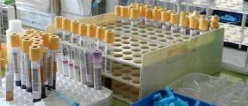 Медицински лабораторни изследвания в Плевен - Лаборатория Имунодиагностика ПП 