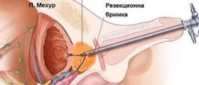 Цистоскопия в град Благоевград - Уролог Благоевград Цистоскопия в град Благоевград - Уролог Благоевград