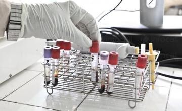 Хормонални изследвания в град Ловеч Хормонални изследвания в град Ловеч