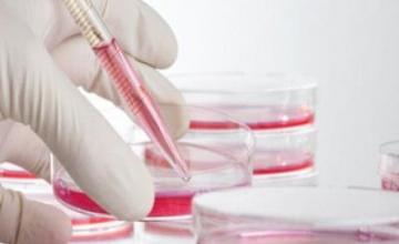 Цитологични изследвания в Горна Оряховица Цитологични изследвания в Горна Оряховица